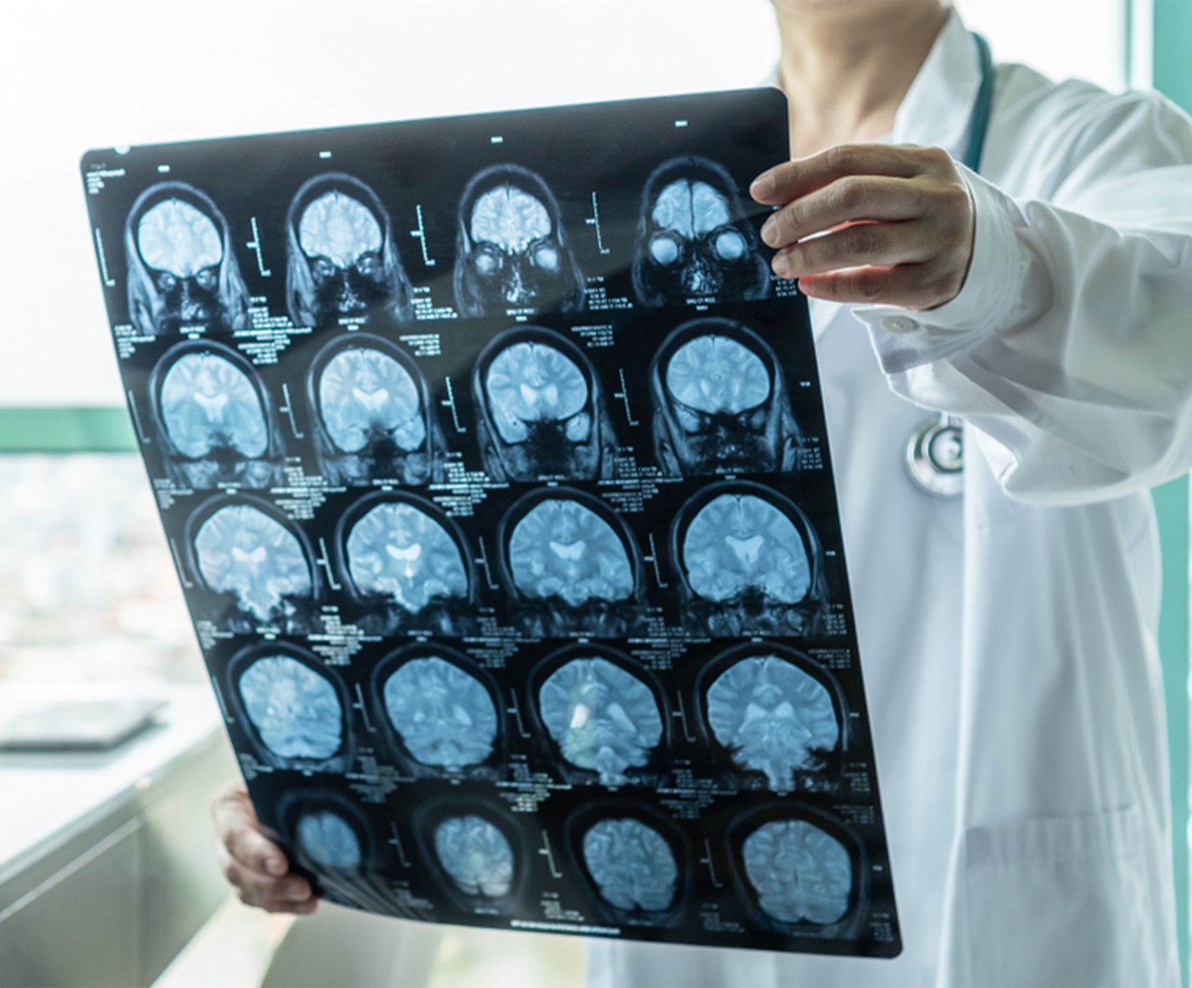Neurology Center
